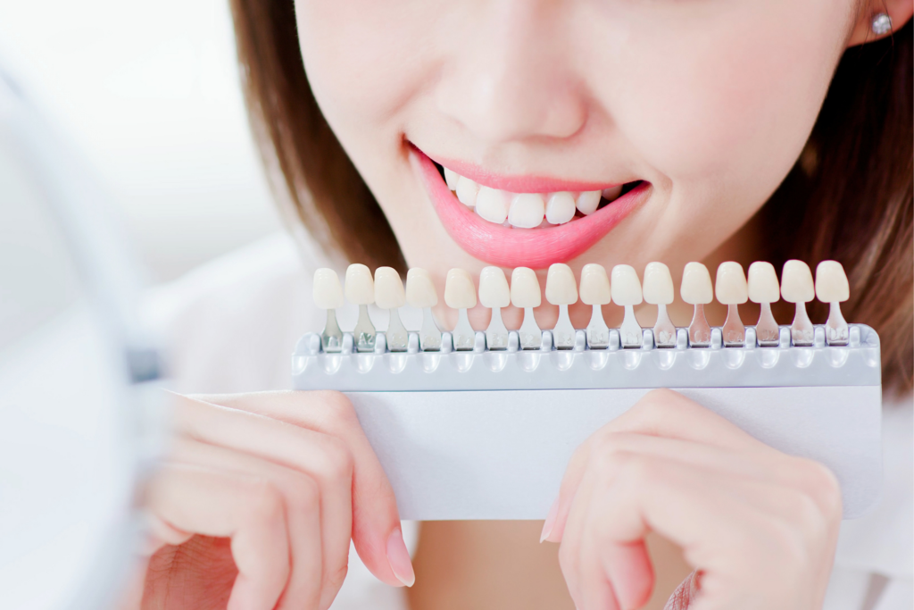 teeth whitening - teeth colors